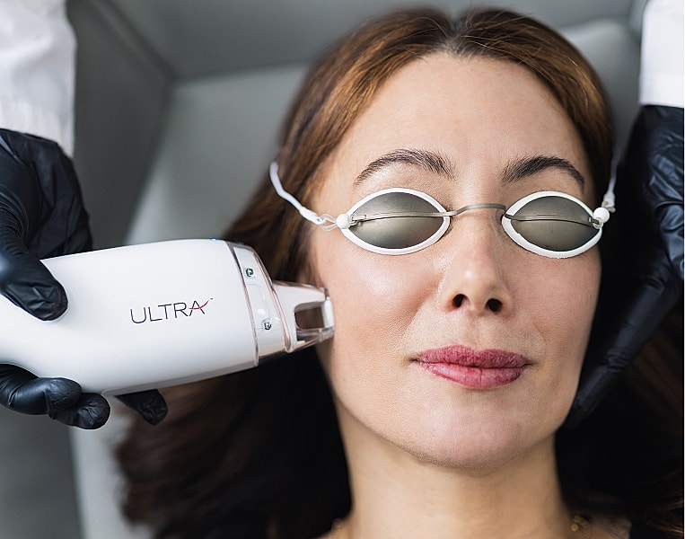 Facial treatment with laser device in progress.